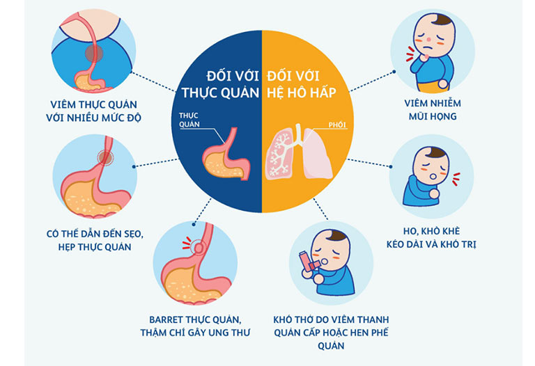 Phân Biệt Nôn Trớ Sinh Lý Và Trào Ngược Dạ Dày Bệnh Lý Ở Trẻ Sơ Sinh